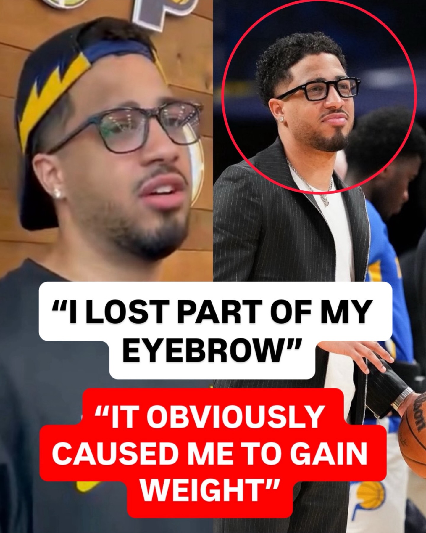 Prayers up for Tyrese Haliburton, he’s dealing with shingles and going through it right now. 🙏

(via romeovillekid/X)