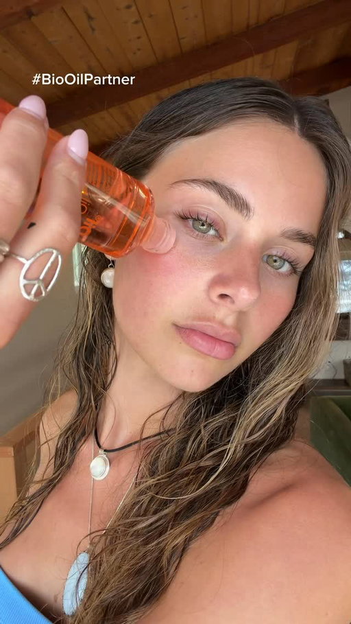 been obsessed with @biooilusa lately ! #BioOilPartner