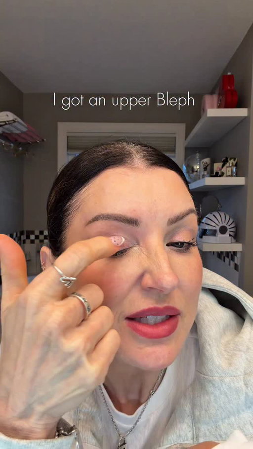 Upper Bleph update ✨
April 2026 ( surgery was March 2025 ) 

Let me know if you have questions! ♥️

#upperblepharoplasty #eyelidsurgery