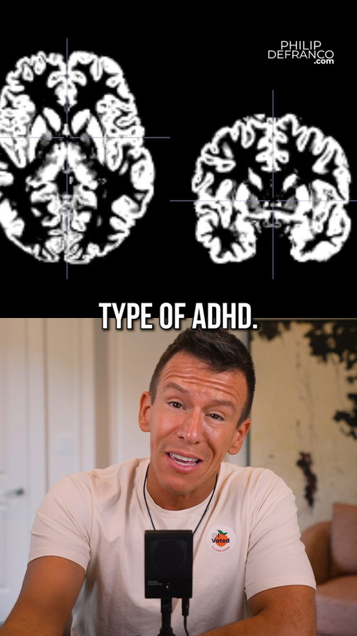 Brain Scans Reveal A Third Type Of ADHD  #USA #America