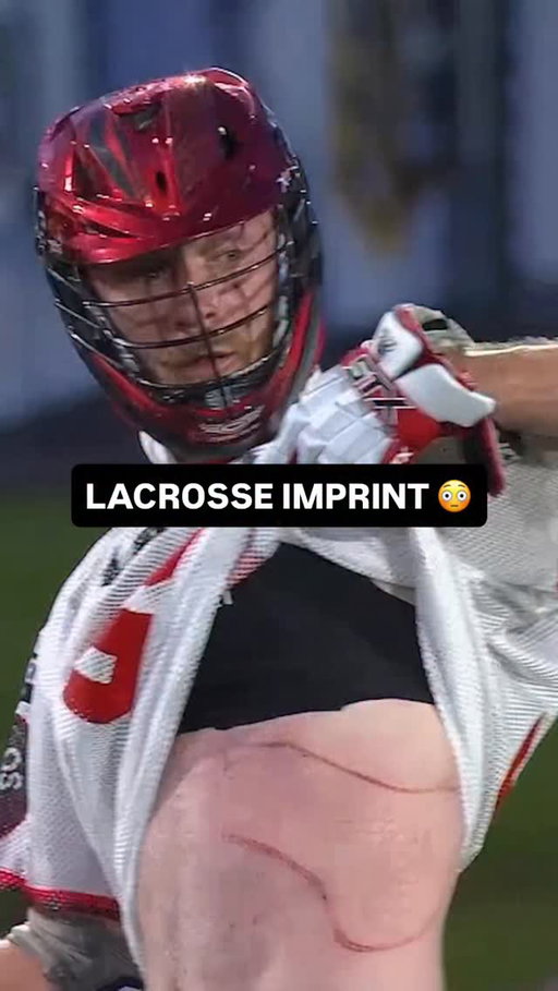 Jack Rowlett was a trooper for this 😳 What a flashback