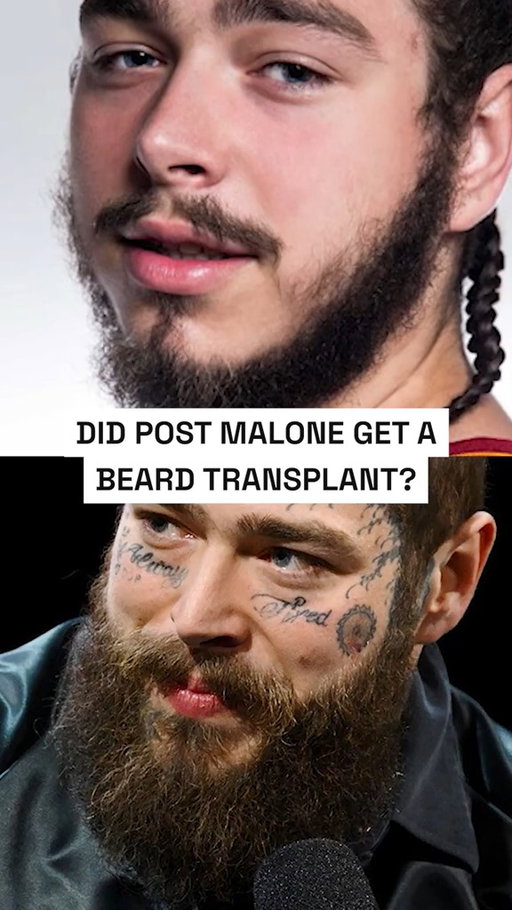 Post Malone Beard Breakdown