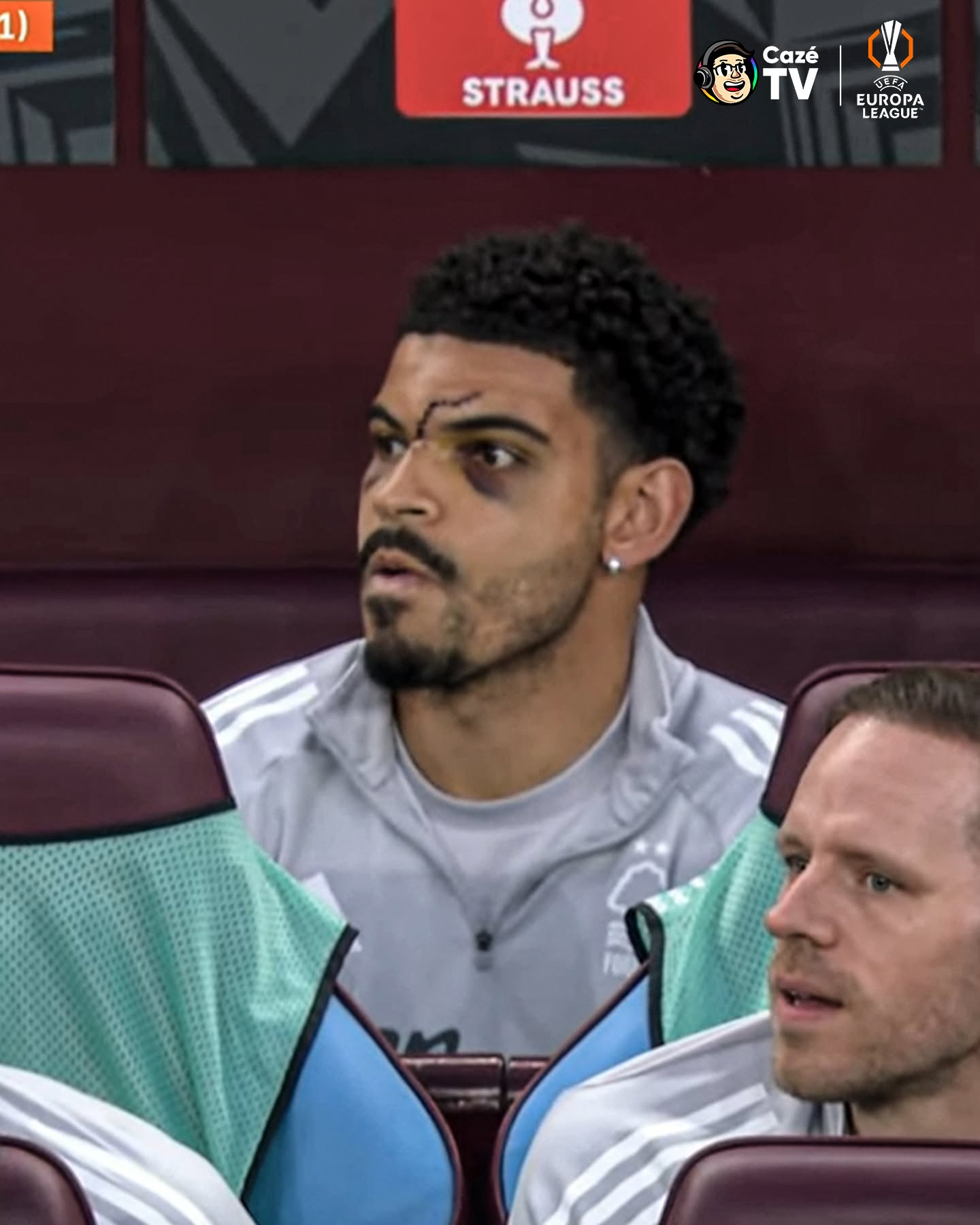 O ROSTO DO MORGAN GIBBS-WHITE ESTÁ UMA LOUCURA! O CARA LUTOU EM CAMPO? QUE ISSSSSSSO! 🤯🤯🤯🤯

🚨 ESTAMOS AO VIVO COM SEMIFINAIS DE EUROPA LEAGUE E CONFERENCE LEAGUE, FILHO! VEEEEEM! 

#EuropaLeagueNaCazéTV #NottinghamForest #AstonVilla #TempoRealCazéTV #cztv16