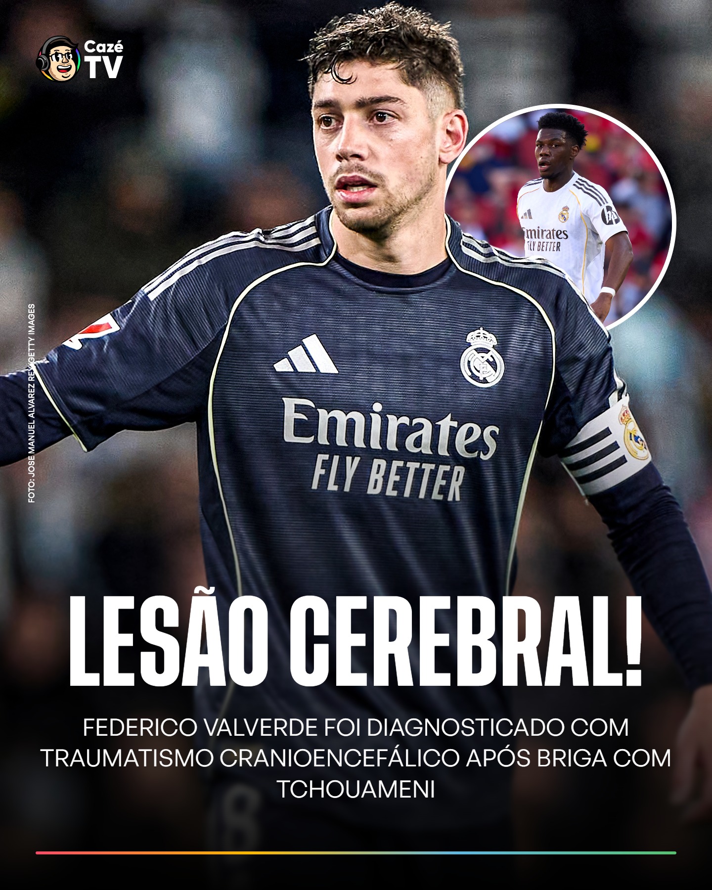QUE B-I-Z-A-R-R-O! FEDERICO VALVERDE TEVE DIAGNOSTICADO UM TRAUMATISMO CRANIOENCEFÁLICO APÓS BRIGA NO CT DO REAL MADRID. O URUGUAIO PRECISARÁ FICAR DE 10 A 14 DIAS DE REPOUSO! 🤯🤯🤯

🗞️ | Fabrizio Romano

#CoberturaCazéTV #RealMadrid #cztv16