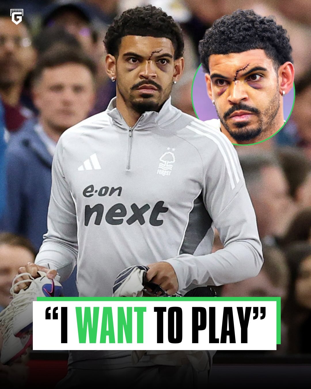 Morgan Gibbs-White won player of the month in the Premier League in the same week he also had a GRUESOME injury...

Despite this, he was adamant on playing in the Europa League Semi Final and featured on the bench for Forrest 💪🏼

An absolute GLADIATOR ⚔