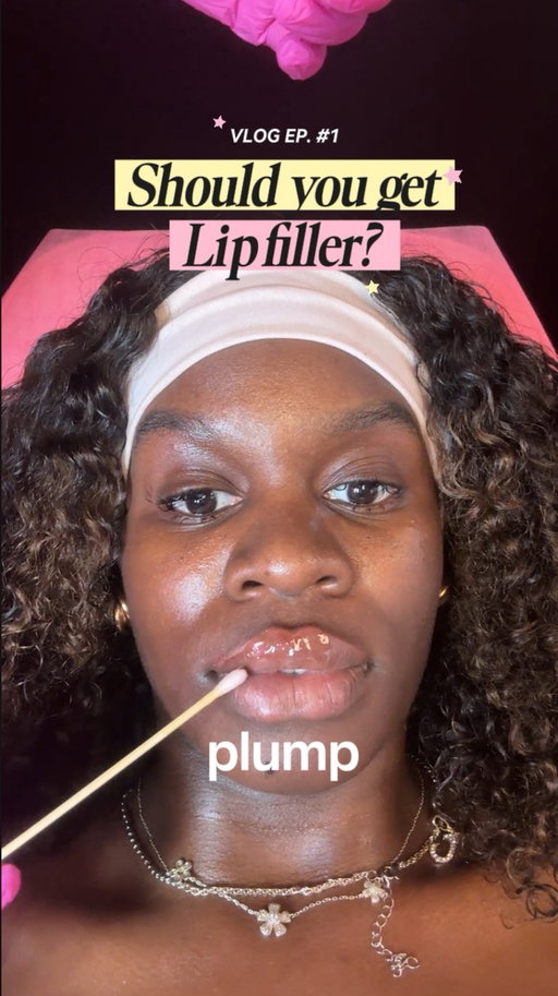 lip filler tips you need before booking that appointment. 

If you’re ready for a fresh, confident glow-up, join @besosandbeauty for your lip filler needs and let your lips do the talking 💋.

#lipfiller #lipfillerblackgirl #maintancedayblackgirl #facialbalancing