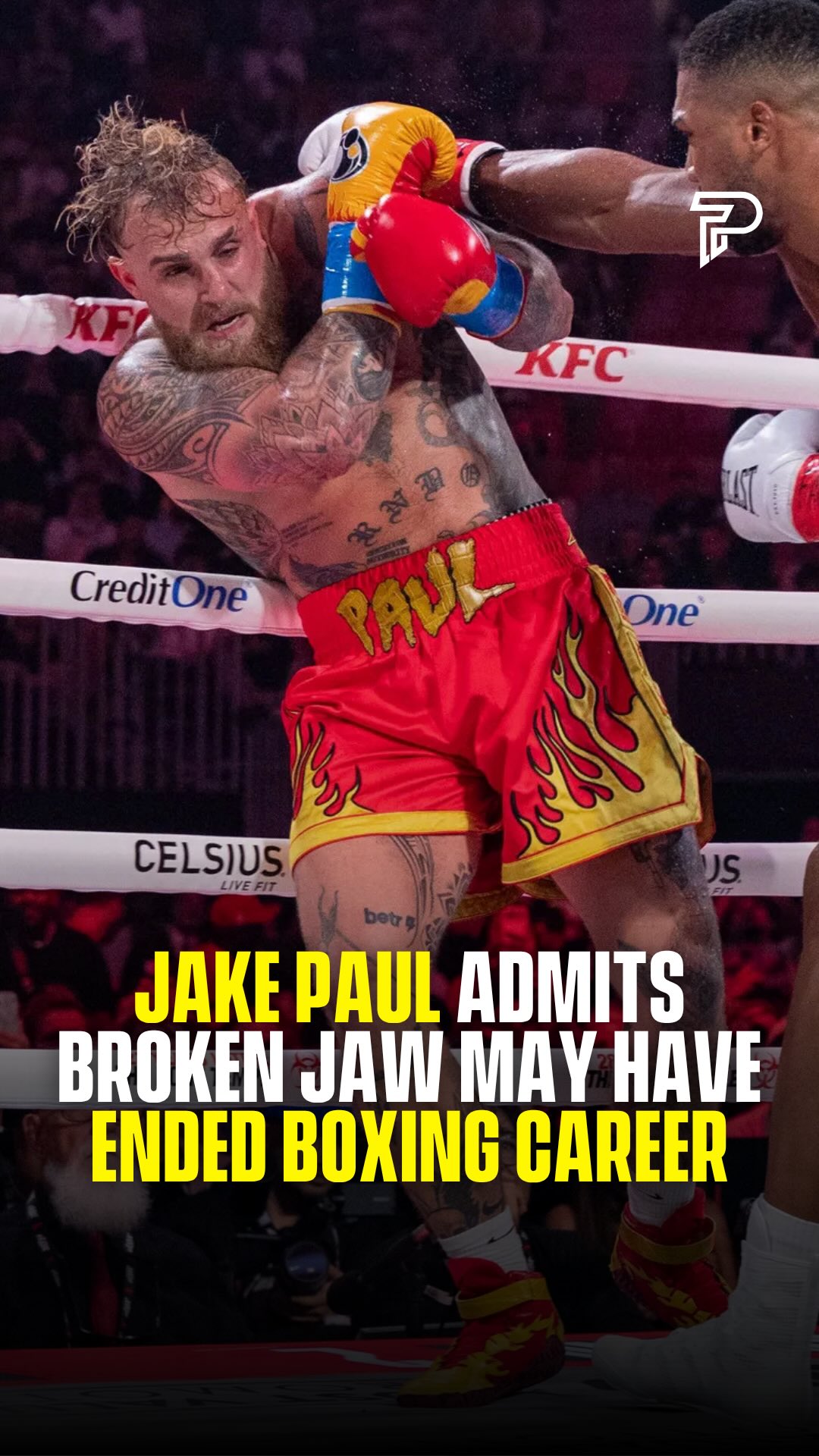Jake Paul has admitted that the broken jaw he suffered against Anthony Joshua in December may have ended his boxing career. Joshua stopped Paul in the sixth round at the Kaseya Center in Miami, breaking his jaw in two places with a heavy right hand that left Paul unable to beat the count.

Paul required surgery afterward, with two titanium plates inserted to stabilize the fractures. He also lost teeth during the fight and will need implants. Five months on, he says the jaw is improving but he still hasn’t been cleared to spar, and his own doctor has advised him against returning to the ring.

Despite all of that, Paul said he has no regrets. The fight reportedly earned him $92 million, and he called the whole experience a net positive for his career, his companies and his content. He finished with 12 wins and two losses across 14 professional fights, though Joshua was the first world class boxer he ever faced.

(via: @jakepaul)

#Pubity #Viral