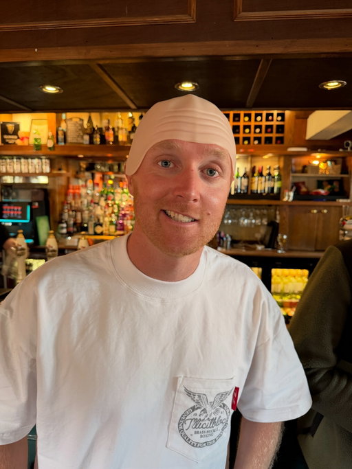 hey guys, I’m wearing a bald cap. Can you tell?