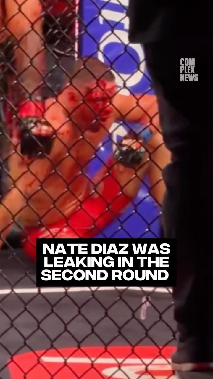 Nate Diaz vs. Mike Perry was a bloody battle 🤯