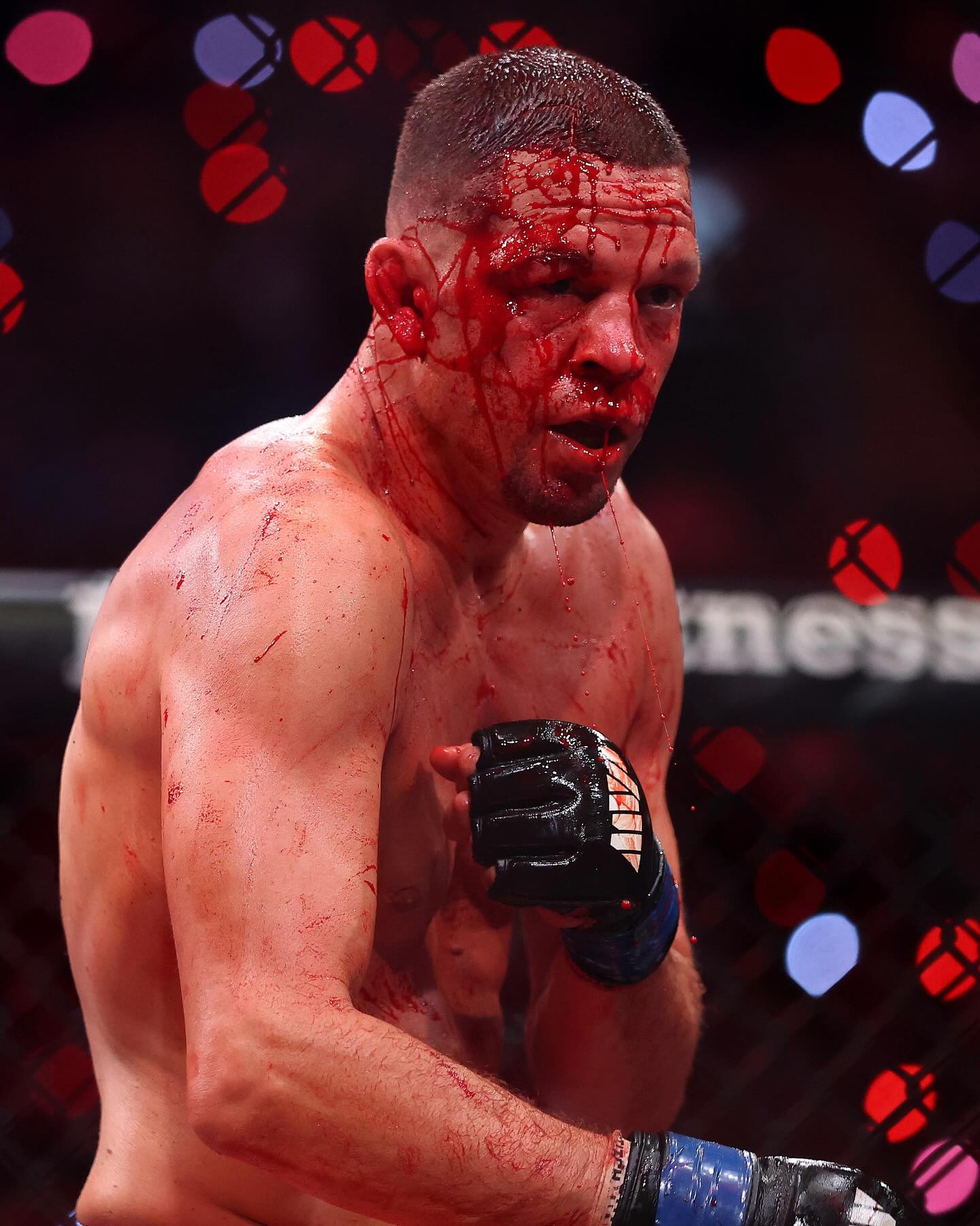 Nate Diaz went through hell tonight vs Mike Perry 😬

[📸: via/ GettyImages]