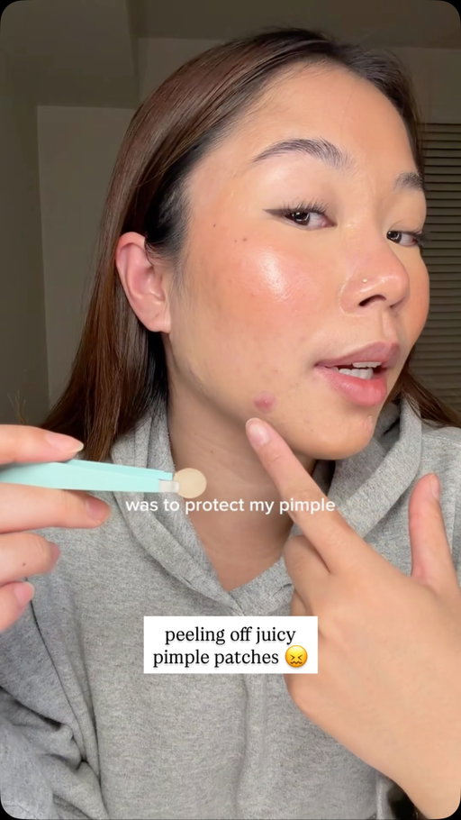 i need my skin to chill tf out 😩 #acne #skincare #pimplepatch @easyderm.official