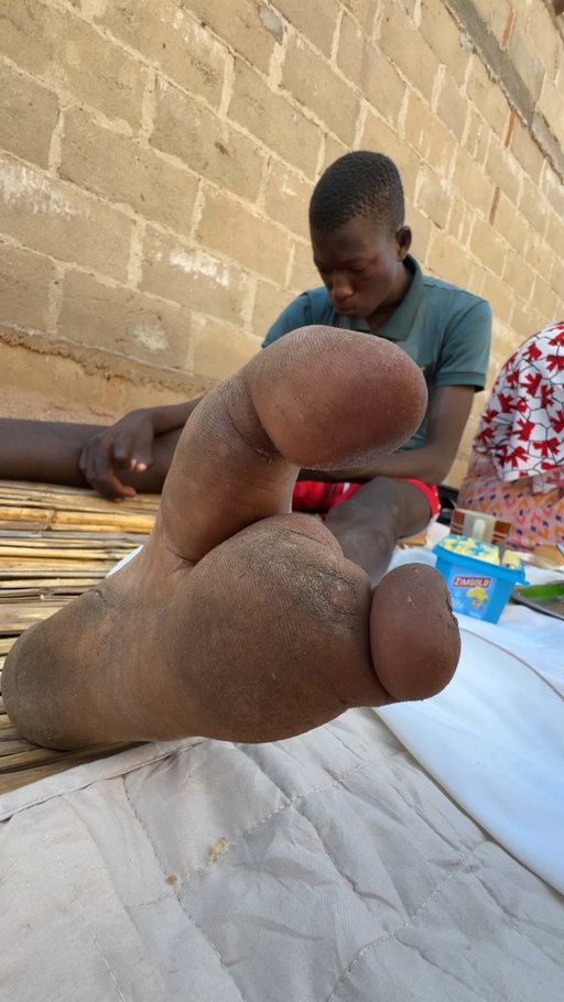 Meeting the Vadoma tribe of Zimbabwe - many members have 2 toes on each foot! 🇿🇼 Was cool that they invited us to a gathering/party that evening, singing and dancing in the middle of nature 😀