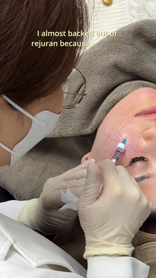 I almost didn’t try Rejuran in Korea because of how painful everyone says it is 😭 …but no pain no gain right HAHA

Honestly my first Rejuran experience was wayyy less painful than I expected thanks to @timereturnclinic_official’s 5-step numbing process + how gentle and precise the doctor was.

Now I finally get the hype around Korean skin treatments because look at this glow ✨

Watch till the end to see my skin after a week!!

Let me know if you guys have any questions bc I was sooo scared before doing this and happy to chat 🫶

#rejuran #koreanskincare #seoulclinic #kbeauty #rejuranhealer