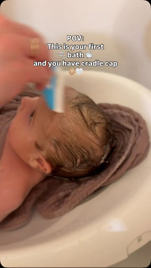 #newbornbath #newborn #cradlecap