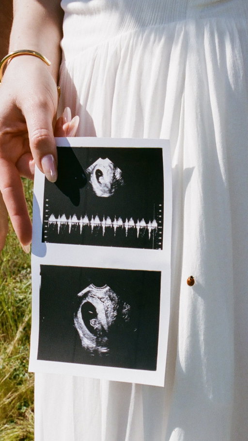The results are in!! What do you think baby Lautner is?💙💗
