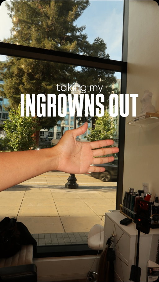 #ingrowntoenail #ingrown #toe #nail