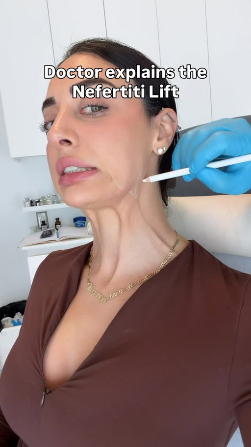 Dr Krasny @dermafina has literally seen me grow up over the last 9-10 years… and at last I found it time to ask him about the Nefertiti lift. He took the time to explain a little what it does to help all of you understand
I’ve taken pics before & once it kicks in I will share the comparison ! 

.
#nefertiti #nefertitilift #botox