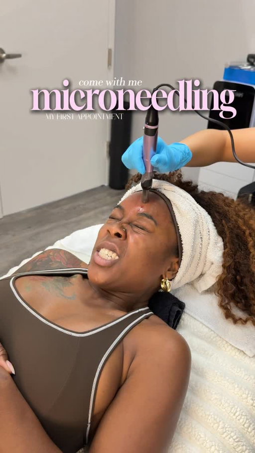 Why didn’t anybody warn meeeee 😭

🧖‍♀️: @angiechouskin 

#skincare #microneedling #maintenanceday