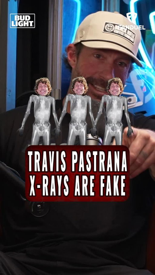 Travis Pastrana breaks down the famous X-ray photo

The guy is practically made of metal 🦾