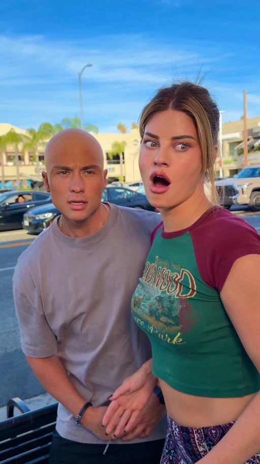 When he’s bald