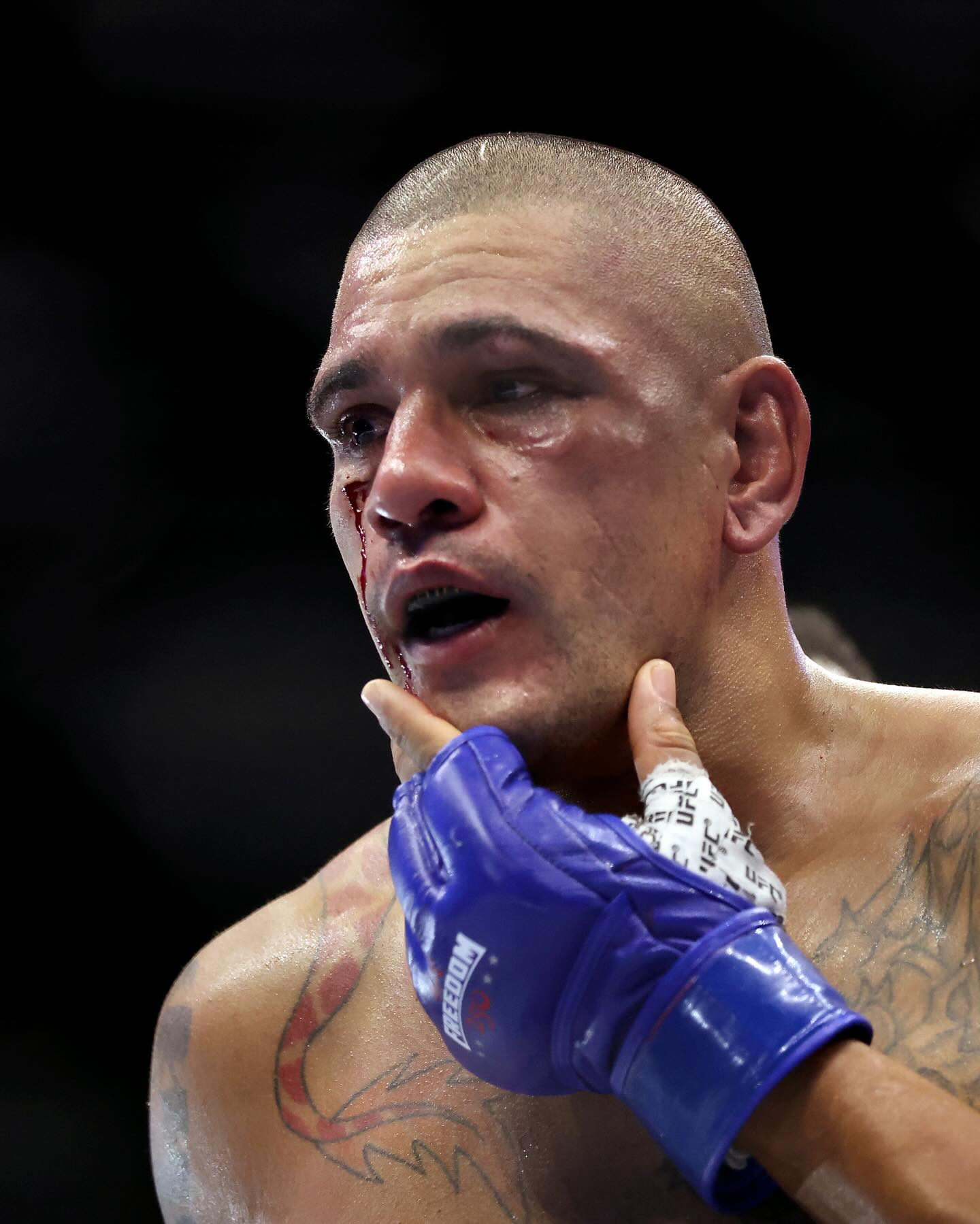 Alex Pereira’s eye tonight against Ciryl Gane at UFC’s Freedom 250 event 🥴

[📸: via/ GettyImages]