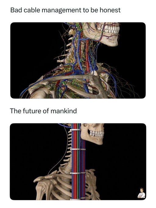 Today, we’re building Human 2.0 to be more ergonomic than the basic human design. First order of business: eyes should come with a zoom function, teeth should automatically regrow like shark teeth, and there should be a loading bar above people’s heads whenever they’re trying to remember someone’s name.

Also, sleep should be optional, calories should expire at midnight, and sneezes should come with a five-second warning instead of arriving like a surprise attack. What improvements would you make before we release the update to production? 

Like this content? Follow us for more @dadsaysjokes ❤️