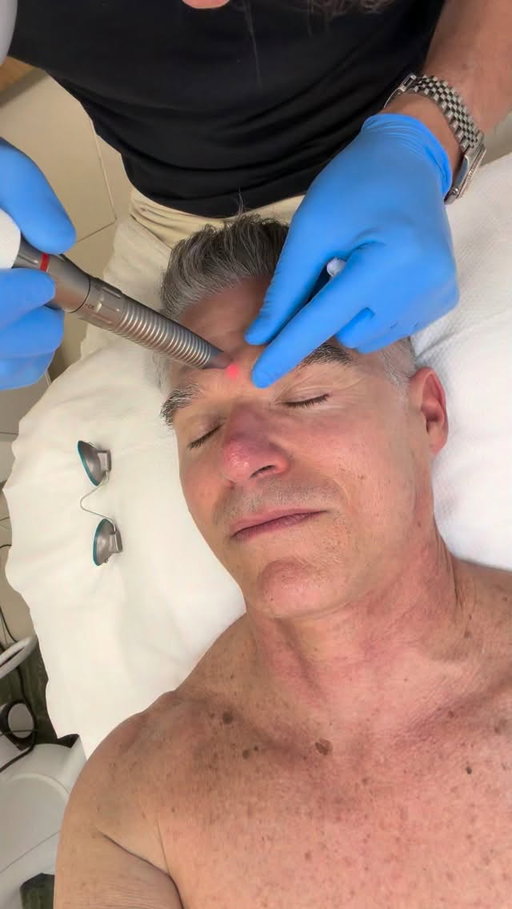 Always time for a great facial! 🙌🏽 I visited my friend @pietrosimoneofficial at his new skincare clinic in the West Village for a very special facial.

It’s 3 cleansing detox steps with one of them using an ozonized cleanser. The Azeliac acid peel exfoliates and resurfaces the epidermal layer.

The special laser works with two different lasers to rejuvenate the skin from the inside out. It also helped to lessen a large dark spot I’d had since I was a kid.

Thank you my friend for that special glow. ☺️