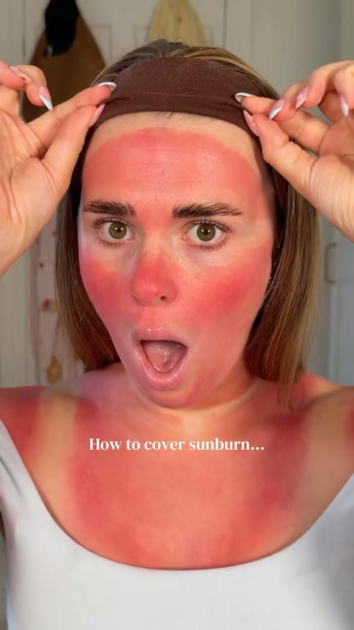 How to cover sunburn 101 🥵 
•
@makeuprevolution colour corrector @nyxcosmetics_uk foundation @sheglam_official bronzer @essence_cosmetics blush,lipgloss @rimmellondon lipliner @maybelline concealer 
•
#makeup #sunburn #colourcorrector #mua #sunbrunmakeup