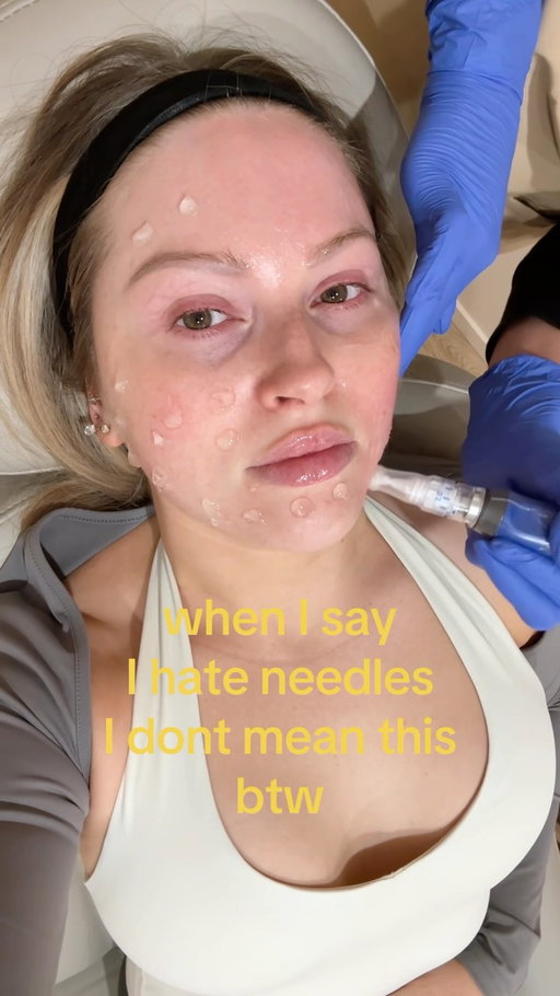 Skinpen 4eva
📍 estetica palmerston nth
@amycarlyon