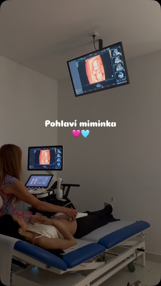 Zítra se to dozvíme. Tipujte v komentářích 🤭