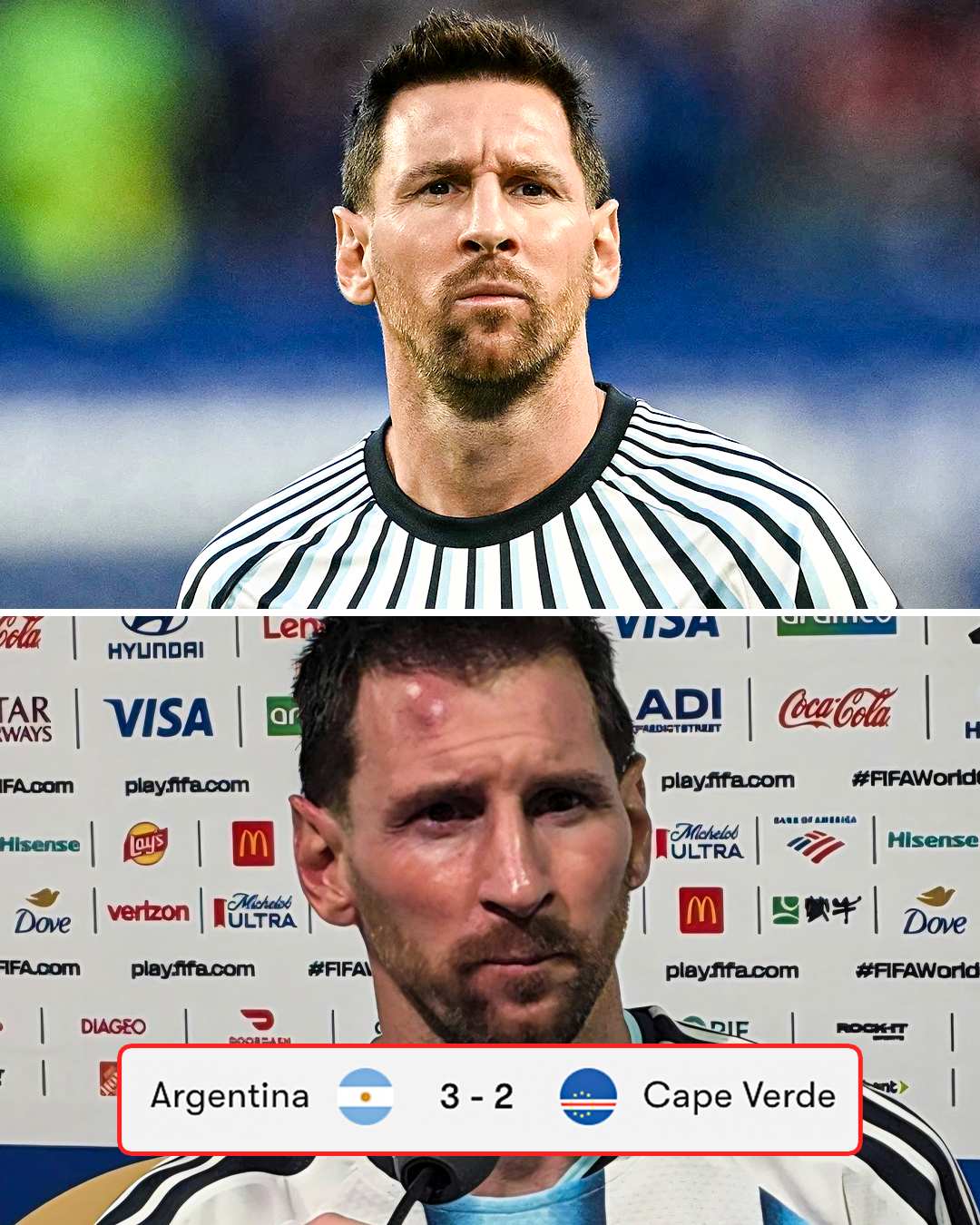 Messi before and after playing Cape Verde 😅

The bruise on his forehead 😳