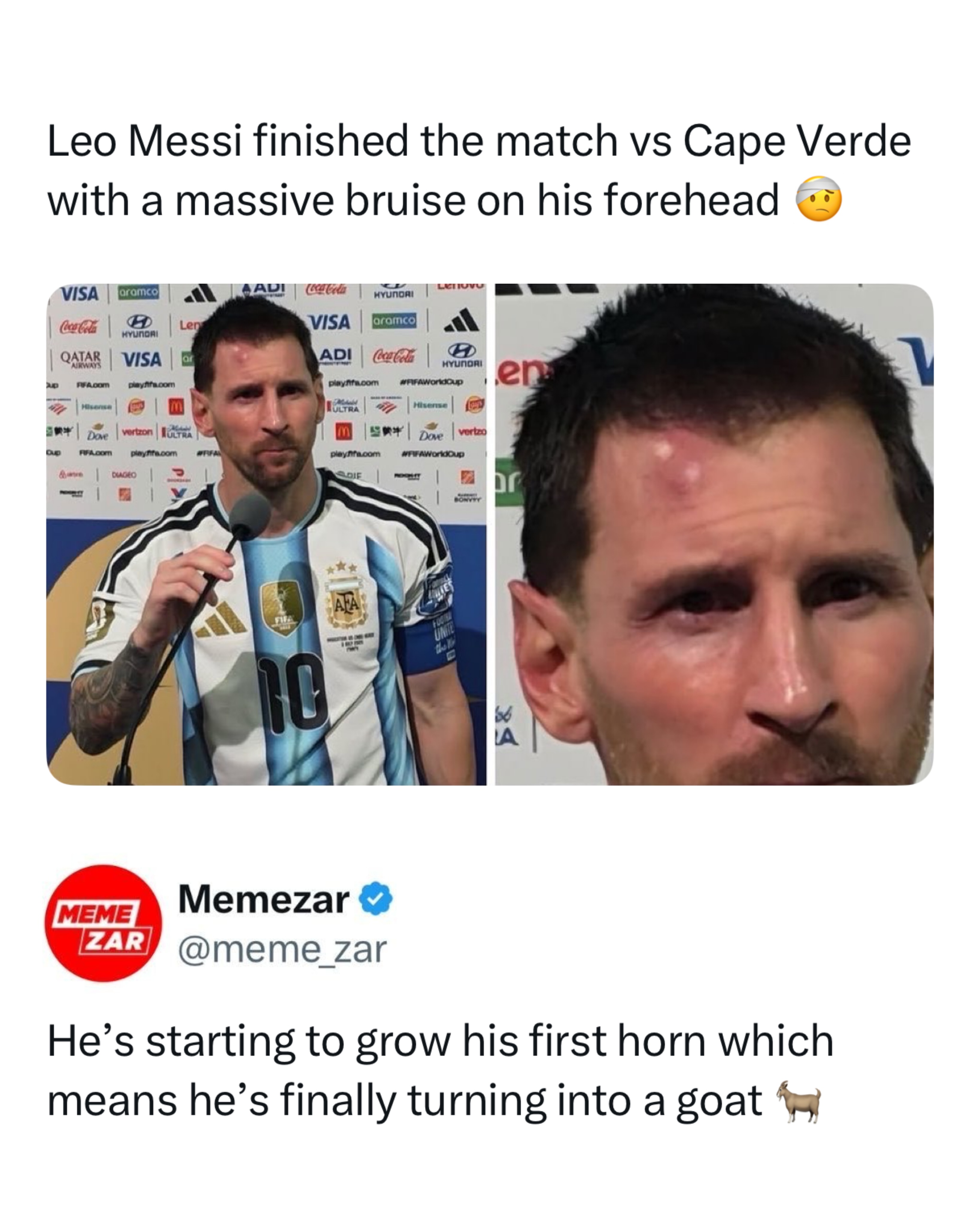 Cabo Verde didn’t just survive Messi, they made him earn every single minute 🇨🇻

By the final whistle, Lionel Messi had a bruised forehead, a missed chance brilliantly denied by Vozinha, and the look of someone who’d just been through 120 exhausting minutes. That’s probably the biggest compliment you can give Cabo Verde. They didn’t make Argentina comfortable for a second. Every tackle, every save, and every attack forced the world champions to fight until extra time before finally sealing qualification.

Football fans aren’t just talking about Argentina advancing. They’re talking about the team that pushed the champions to their limit and left one of the greatest players ever battered, frustrated, and relieved to hear the final whistle. Cabo Verde may be out of the tournament, but they leave having earned the respect of players, fans, and the entire football world.