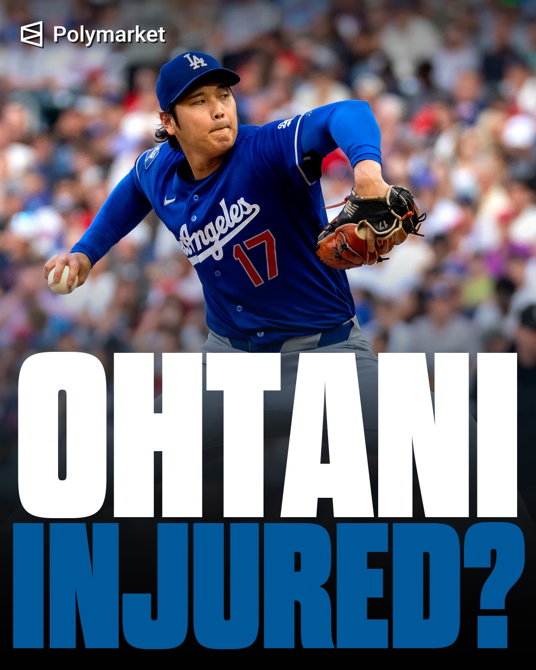The Dodgers got almost everything they wanted from Shohei Ohtani.

Six innings. Nine strikeouts. A season-high 110 pitches. A quality start against San Diego.

Then came the part that makes the whole franchise hold its breath.

Ohtani felt tightness in his right biceps during his final at-bat and left early. The good news is that it bothered him while swinging, not pitching. The Dodgers are calling it precautionary, and he is sitting Saturday to be safe.

That might be the right move.

But this is Ohtani. He is not just one player in the machine. He is the ace version, the DH version, the entire daily conversation.

The Dodgers won the game anyway on Teoscar Hernández’s grand slam.

Still, the only thing that matters now is how Ohtani feels next.