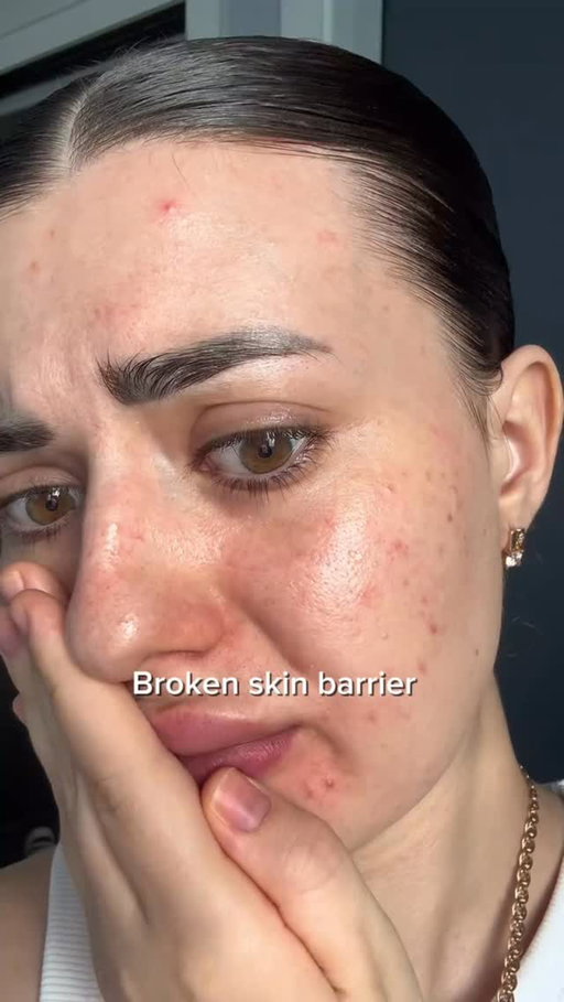 The fastest way to support a damaged skin barrier