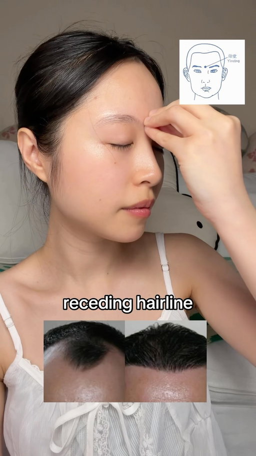 Easy daily routine for hair volume, shiny hair, and receding hairline✨

#headmassage #hairgrowth #haircare  #hairline #hairlosssolutions haircaretips hairloss hairlosssolution haircareroutine