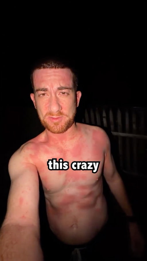 I got a life threatening rash an a remote island in The Philippines. It was one of the scariest travel moments of my life. What would you do in this situation?