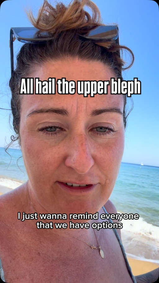 All hail the upper bleph