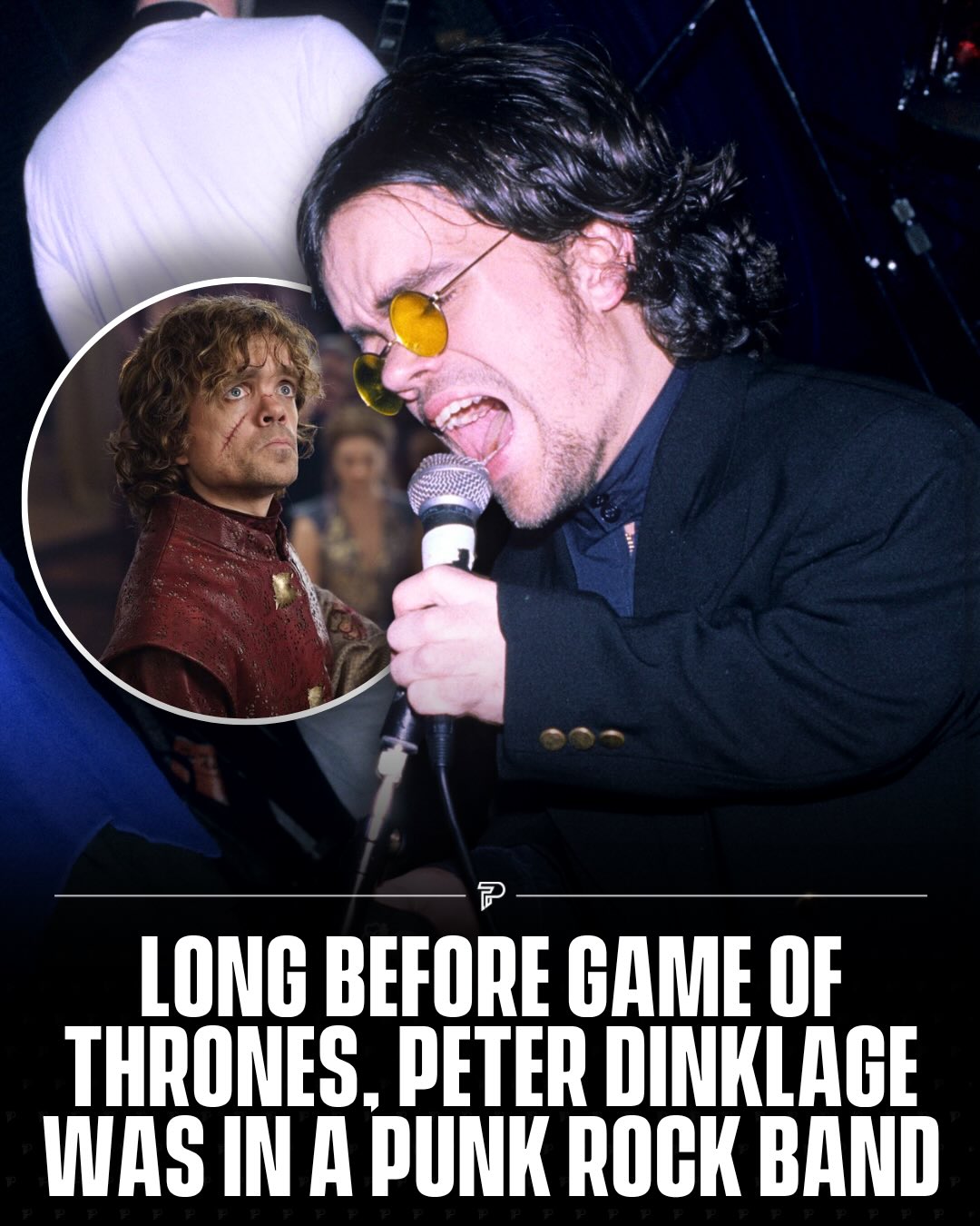 Before he was Tyrion Lannister, Peter Dinklage was co-frontman of a New York City band called Whizzy in the early ‘90s.

The group blended punk, funk, and rap and were wild enough live that Dinklage walked away with a scar running from his neck to his eyebrow after one show.

He later told The New Yorker they were “punks who didn’t play punk rock.” No footage of the band has ever surfaced online.

#Pubity #Viral #Music