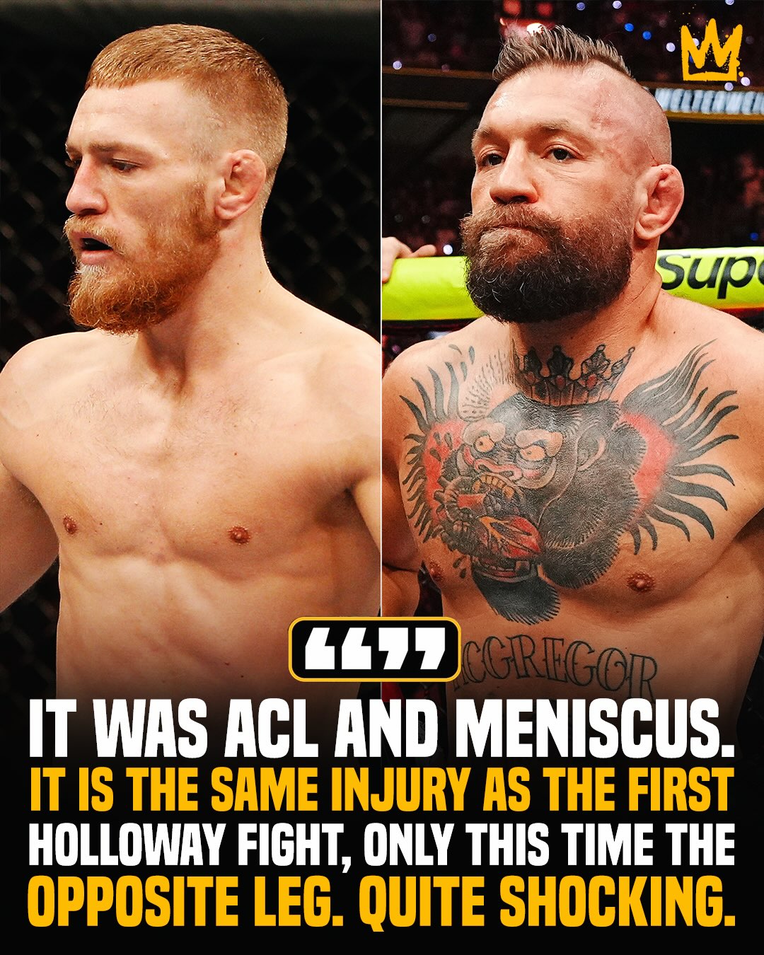 Maybe fighting Max Holloway is just bad luck for Conor McGregor 😳