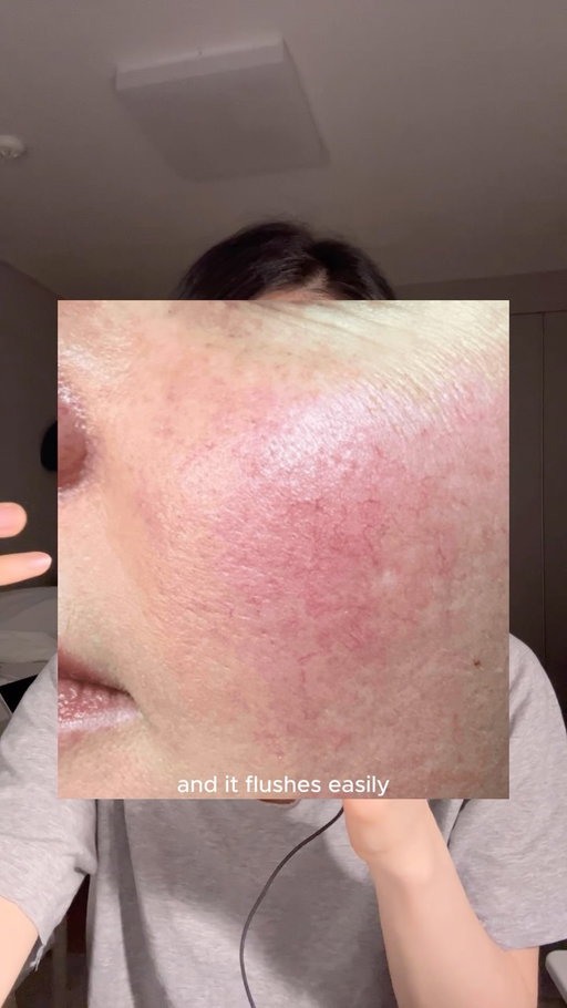If your skin is thinning, more sensitive and gets fine lines easily you might get help from copper peptide + pdrn combo

Product mentioned: @rejuall_official pdrn copper peptide serum

#copperpeptides #rejuall #pdrncopperpeptides #copperpeptideserum #koreanskincare