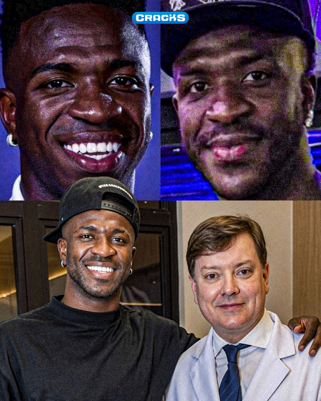 ¡VINICIUS SORPRENDE EN REDES! 👀

🇧🇷 Según el periodista Leo Dias, el jugador del Real Madrid se habría sometido a una mentoplastia para definir y dar contorno a su barbilla.