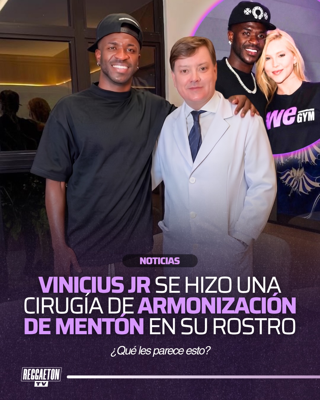 Vinícius Jr. sorprendió a sus seguidores al aparecer con un cambio en su rostro tras someterse a una cirugía de armonización del mentón.

La estrella del Real Madrid y de la selección de Brasil mostró su nueva imagen, generando todo tipo de reacciones en redes sociales, donde muchos comentaron el notable cambio en su apariencia.

¿Qué opinas del nuevo look de Vinícius Jr.?
.
Sigue a @reggaetontv para más contenido‼️