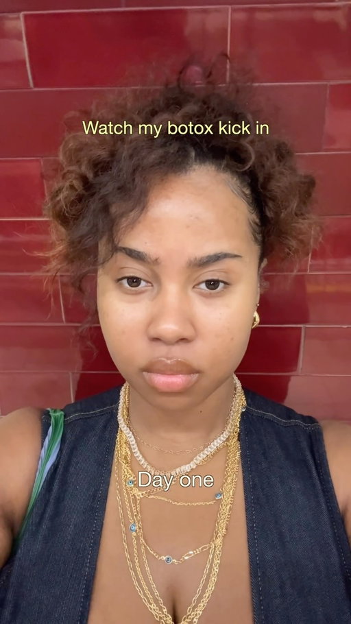 First time trying Botox at 28 and I have thoughts 😂

I went to @dr.arreni asking for a brow lift with a natural finish, not fully understanding that a brow lift needs more product than your average treatment. So we did a follow up, added a little more, and this is what kicked in.

Nobody needs this. I want to be really clear about that. But I wanted to try it, I trusted the process, and at 28 in the age of beautymaxxing, that felt like enough of a reason.

What I love most about where we are right now is that beauty looks completely different for everyone. Full glam, no makeup, injectables, none of the above. There is no right answer and there is no version of this that you owe anyone.

I just wanted the lift. And I’m obsessed with it 💛

More beautymaxxing content is coming because I have been trying things and I am not keeping it to myself. Comment 🫦 and I’ll keep you in the loop xo

#botox #browlift #beautymaxxing #beautytips #injectables