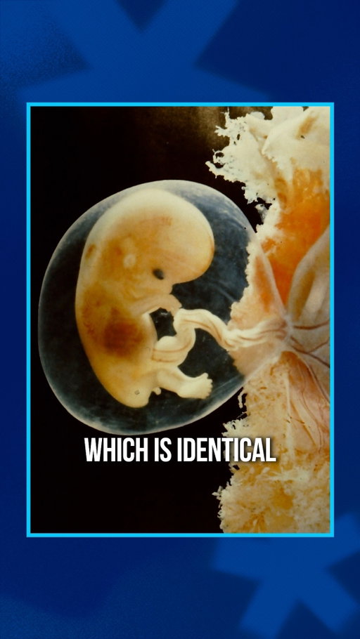 The placenta creates an entire human through cell signaling.

What if those same biological signals could help support healthier aging?

#cellsignaling  #regenerativemedicine  #longevity  #healthspan
