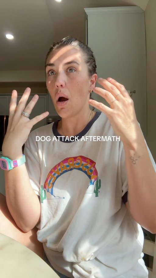 Welp 😵‍💫😩 there’s no winning here. #rachonlife #momlife #dogbite #millennialmom