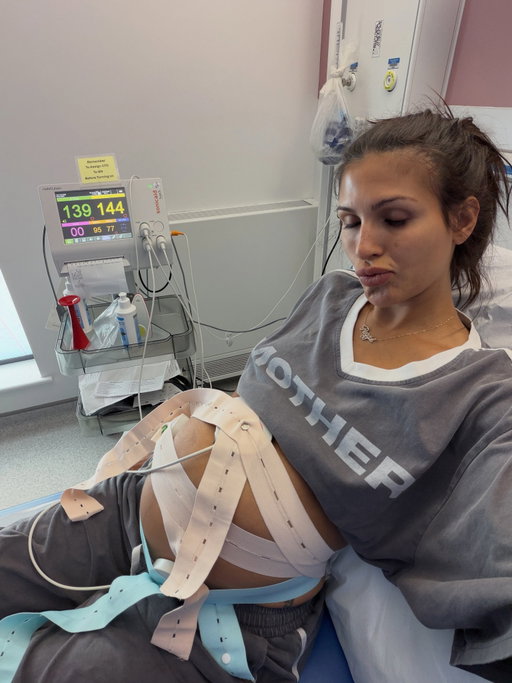 Ok so 36 week pregnancy update…🤰🏽
I had my weekly scan and consultant appointment yesterday to be told I now have pre eclampsia. tbh Im surprised I didn’t get diagnosed sooner as I’ve had all the symptoms for a couple weeks now. Sooo given now that’s my liver (ICP) and kidneys are both f**ked and according to the blood flow from my scan it’s indicating that baby girl is going into survival mode, where blood is only going to her heart and brain as supposed to anywhere else like her stomach - she has now gone down to 1st centile, which isn’t great. 
So I have now been booked in for a c section as it’s the safest option for all of us. 
I’ve been very overwhelmed this last trimester and I’ve really tried to push through all the pain and sleepless nights but I do agree I think it’s time especially as babygirl is struggling too. It’s just upsetting that giving birth how I would have liked has been taken out my hands once again.
You prbs won’t know when I go in for my section… but there will be signs😅 I’ve had my pre ops and dreading the epidural as how horribly wrong it went last time 😭 but tbf I’ve never heard of a bad experience from a planned c section and hopefully they can sort out my old bodged scar. (Silver lining right?)
Anyway, peace and love and enjoy these depressing pictures apart from the cat that came to comfort me whilst I was ugly girl crying eating my chicken wrap on the pavement lol xoxox