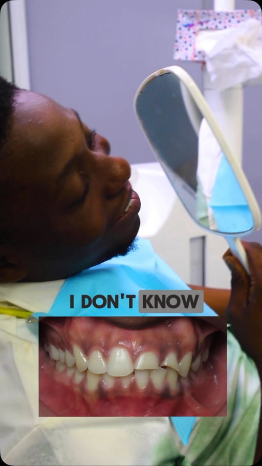 At first, he was hesitant. Full of doubts and unsure if it was worth it. Today, he’s smiling with confidence and wishing he’d done it sooner.

Your transformation could be next. ✨

📍Smile360 Dental Specialists
Book your cosmetic consultation today.
#NewSmileNewYou #Smile360 #SmileTransformation #CosmeticDentistry #lagos