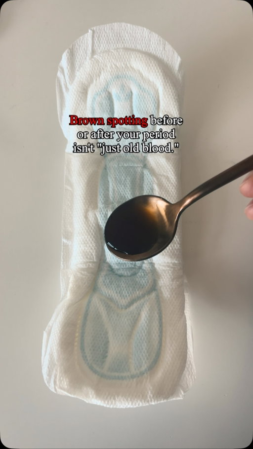 Brown spotting before or after your period is not something to automatically ignore. Here is what it may be telling you 👇

It is not always “just old blood.” In some cases, spotting can be associated with hormonal changes, including progesterone patterns.

Here are a few things worth paying attention to:

🩸 Brown spotting before your period: Can sometimes occur when the luteal phase is not as strong or consistent as expected.

🩸 Brown spotting at the end of your period: May sometimes be associated with lower progesterone relative to estrogen.

😴 PMS, mood changes, sleep disruption, and cravings: These can also be connected to changing progesterone patterns.

🔬 Pay attention to the pattern: Brown, streaky, or prolonged spotting that happens consistently is worth discussing with your provider rather than automatically dismissing it.

🌿 Support healthy hormone function: Adequate protein, quality sleep, stress management, and stable blood sugar are good foundational habits.

🩺 If spotting is recurring: Mid-luteal progesterone testing may be something to discuss with your provider to better understand what is happening.

Brown spotting can have multiple causes, so it should not automatically be assumed to mean low progesterone. But when it becomes a consistent pattern, it is worth investigating.

Have you noticed this pattern across multiple cycles? Save this for your next appointment ✅

Educational content only. Not medical advice. Individual results vary.

#HormoneHealth #Progesterone #WomensHealth #PeriodHealth #Ivologist