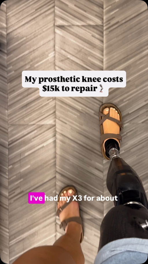 No one was in the wrong for the cost to be this high- the repair costs what it costs from the company that makes my knee (which I’ve absolutely loved for the last 4 1/2 years), and my clinic has been incredibly helpful.

The reason for these scenarios is really because of insurance companies. I’m in a weird gap- equipment js typically under warranty for 3 years, but insurance companies aren’t covering new prosthetics every 3 years anymore. So I’ve been in this weird gap where I was hoping to hang on as long as possible before increasing my premium to get a new prosthetic leg, anddddd here we are. 😅 Insurance with a prosthesis is actually the worst, but we’re figuring it out!

By the way, no one is paying me to taking about specific equipment - I’m just telling y’all my honest experience as I go. I’ll keep you updated on my thoughts!