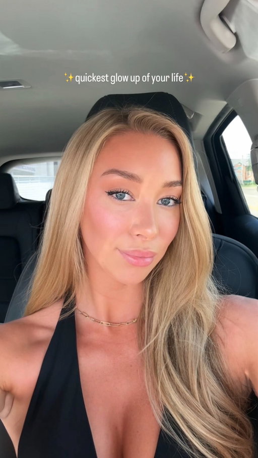 Just @preservationbeauty and @liv_aesthetically_ giving me the best under eye glow up ever!! 💉🤍 I’m so obsessed with the results and feel like a new person, it only took 15 min!